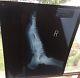 Michael Jackson Original Period X-ray 10 X12 Historical Museum Piece Not Signed